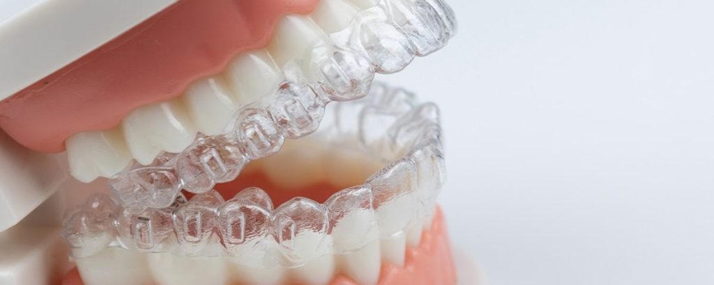 Revolutionising Orthodontics: How Invisalign Enhances Oral Well-being