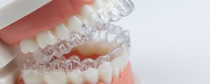 Revolutionising Orthodontics: How Invisalign Enhances Oral Well-being