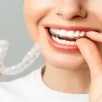 How Invisalign Treatment Plans Are Customised Using Digital Tooth Movement Predictions