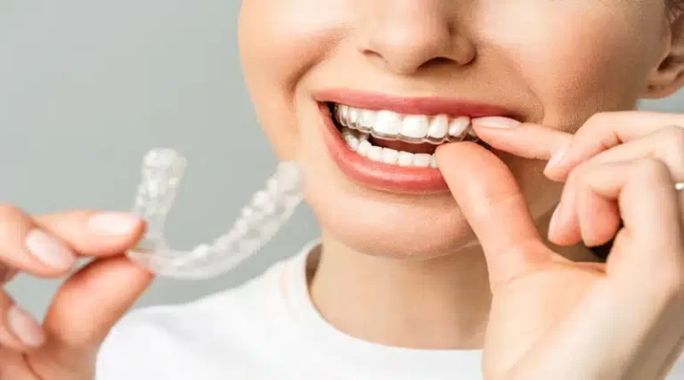 How Invisalign Treatment Plans Are Customised Using Digital Tooth Movement Predictions